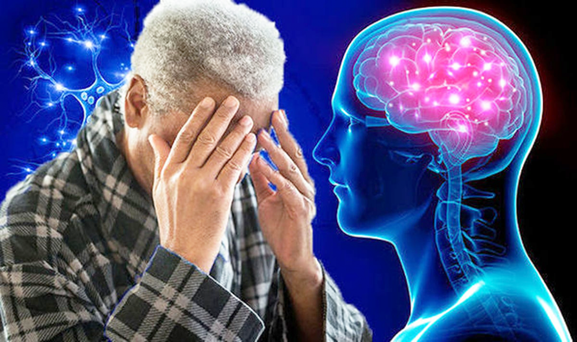 Alzheimer được biết đến là căn bệnh “đánh cắp ký ức”