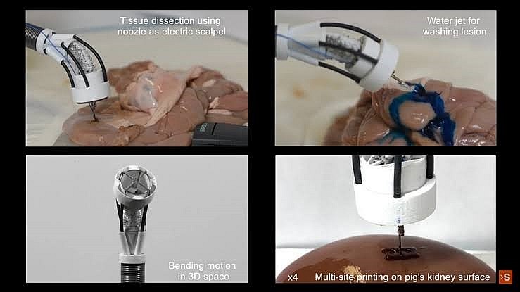 Nguyên mẫu máy in sinh học 3D linh hoạt có thể phục vụ như một công cụ phẫu thuật nội soi đa năng. Nguồn: UNSW Sydney YOUTUBE