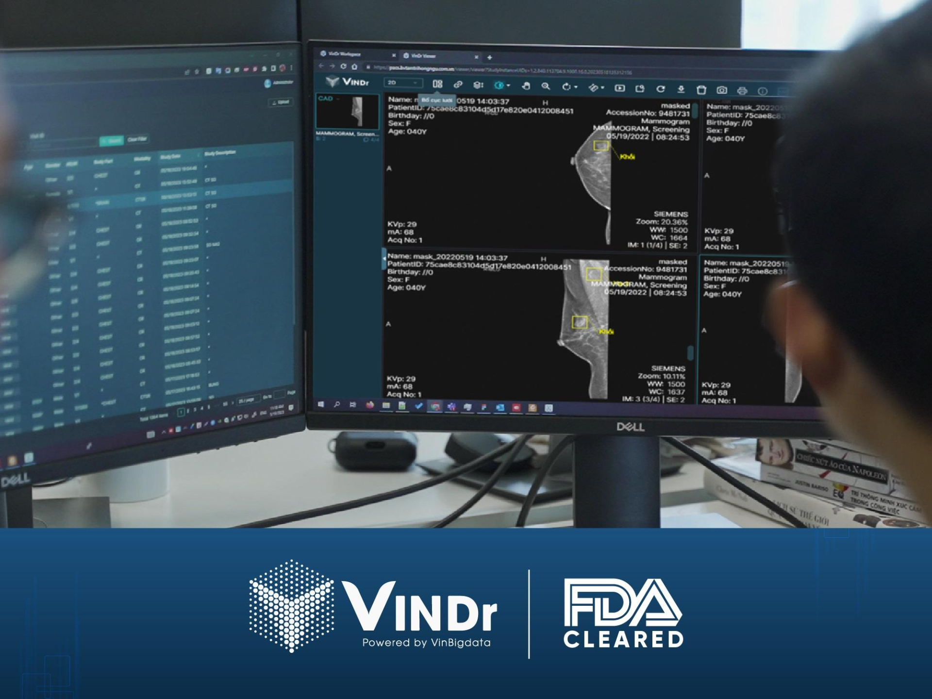 VinDr trở thành sản phẩm AI cho chẩn đoán X-quang tuyến vú đầu tiên và duy nhất tại Việt Nam được FDA công nhận.