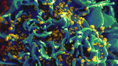 Sắp thử nghiệm lâm sàng vaccine ngừa HIV
